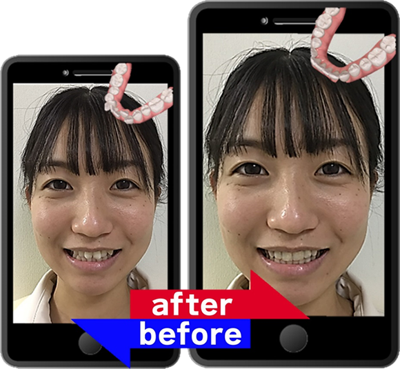 矯正治療before&after