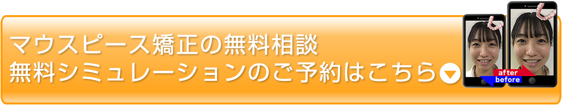 24時間WEB予約