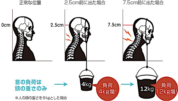 姿勢とかみ合わせの関係