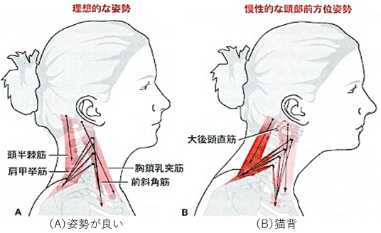 姿勢とかみ合わせの関係