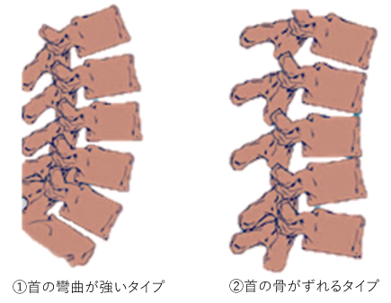 姿勢とかみ合わせの関係