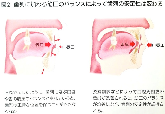 “姿勢の改善によって患者さん自身の生活も大きく変わる