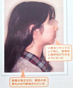 Aさんの物語