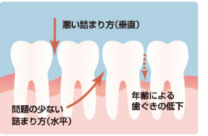気が詰まる